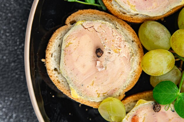  Foie Gras enceinte : peut-on en consommer en toute sécurité ?